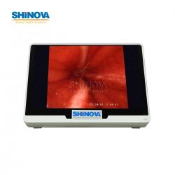 Мобильный Ветеринарный Видеоэндоскоп с 10-Дюймовым Сенсорным Монитором